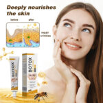 botox2_1757932212.jpg