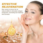 botox4_1757932214.jpg