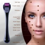 derma-roller-titanium-micro-needle-drs-540-pins-derma-roller-stainless-steel-for-facial-skin-care-hair-loss-treatment-tool-5_1727331614.webp