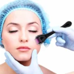 derma-roller-titanium-micro-needle-drs-540-pins-derma-roller-stainless-steel-for-facial-skin-care-hair-loss-treatment-tool-6_1727331614.webp