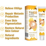 vitigo2_1758004465.jpg